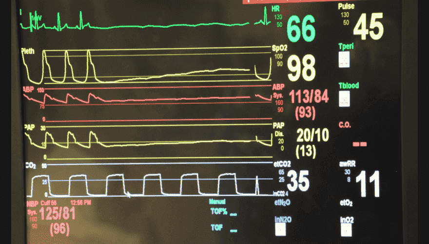 Monitor Technician Monitor Technician - Top 14 Hospital Jobs For Students